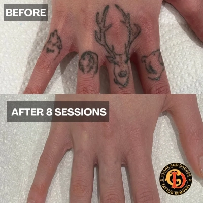 b-a-08-sessions-02
