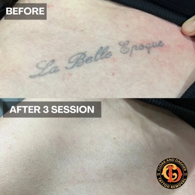 b-a-3c-sessions